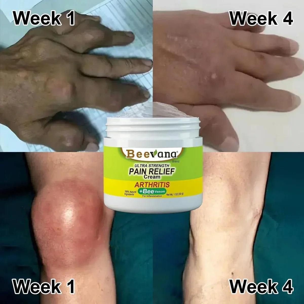 Bee Venom Joint and Bone Therapy Cream - (Buy 1 Get 2 FREE 🔥)