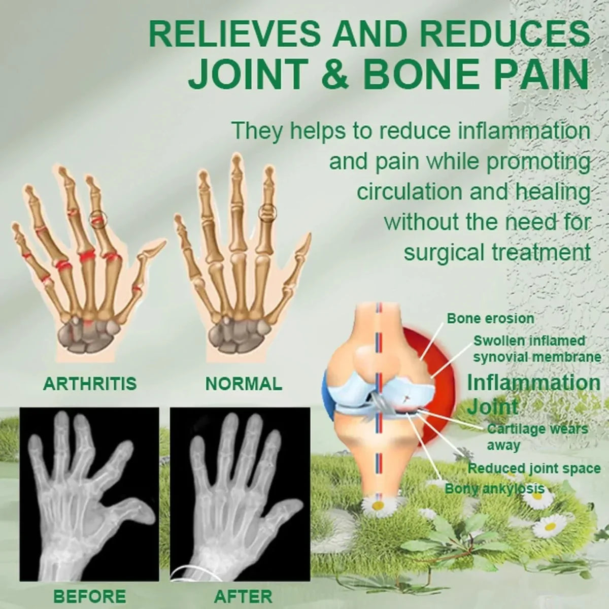 Bee Venom Joint and Bone Therapy Cream - (Buy 1 Get 2 FREE 🔥)